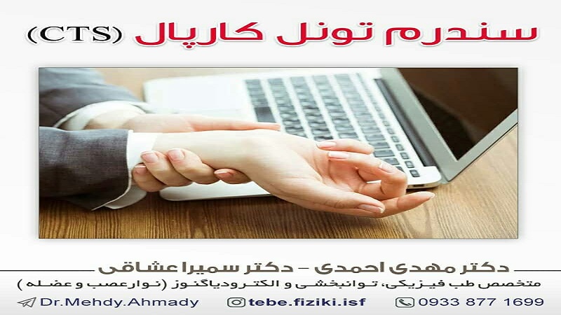 سندرم تونل کارپال یا به اختصار CTS