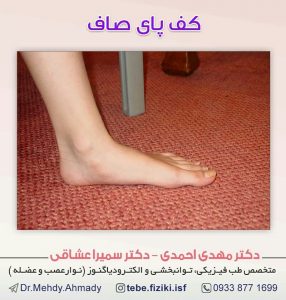 کف پای صاف