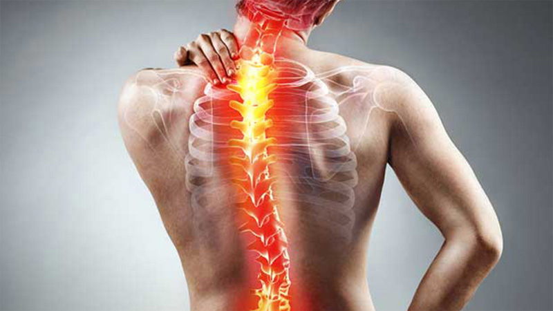 نکات مهم گودی و انحراف کمر | متخصص طب فیزیکی و توانبخشی اصفهان