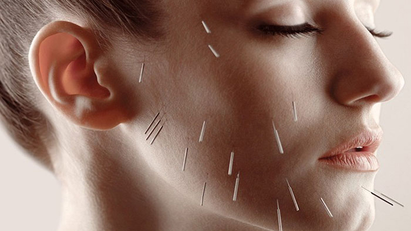 بیماریهای قابل درمان با طب سوزنی | متخصص طب فیزیکی و توانبخشی اصفهان