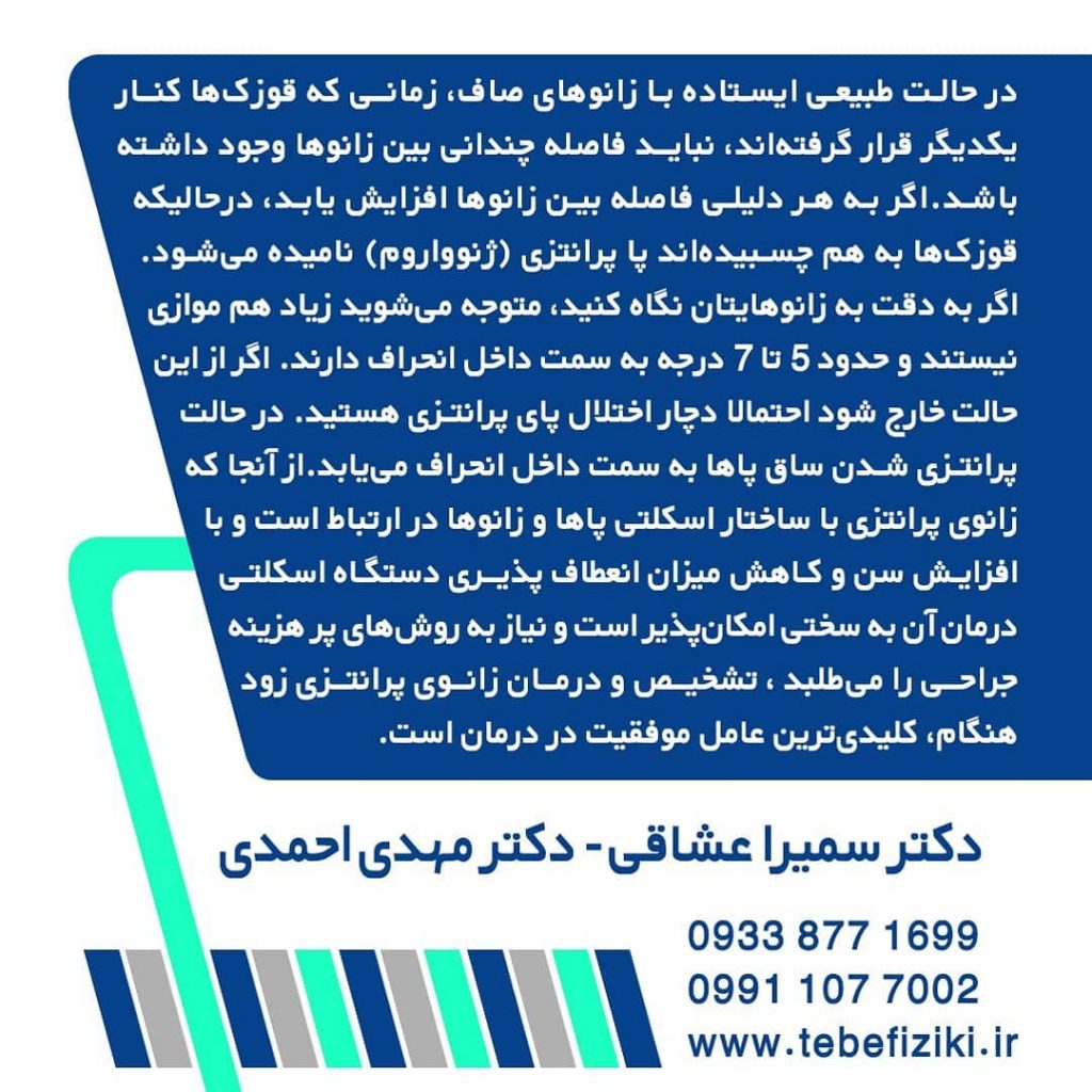 پای پرانتزی | متخصص طب فیزیکی و توانبخشی اصفهان