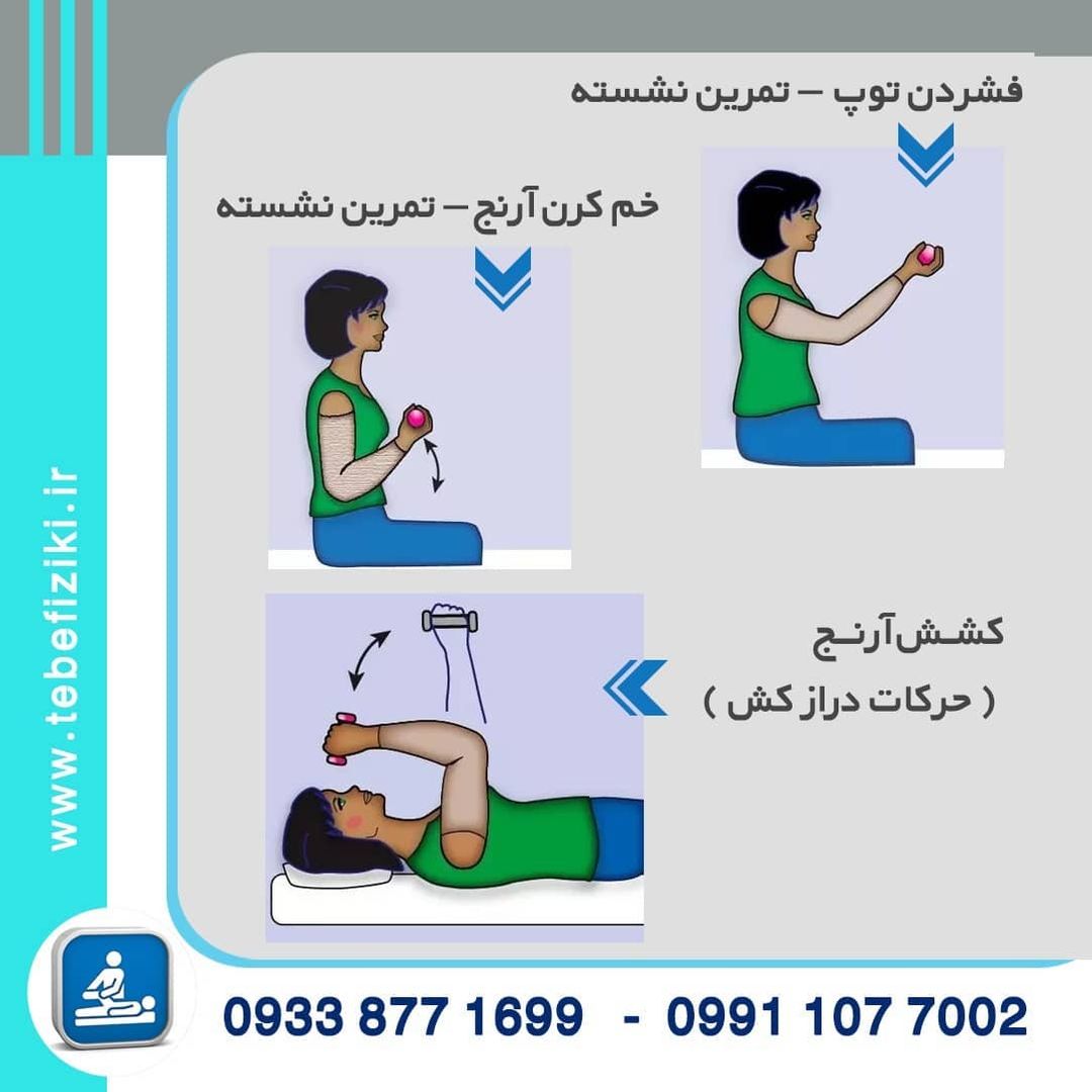 ورزش های مخصوص لنف ادم  دست و پا | متخصص طب فیزیکی و توانبخشی اصفهان