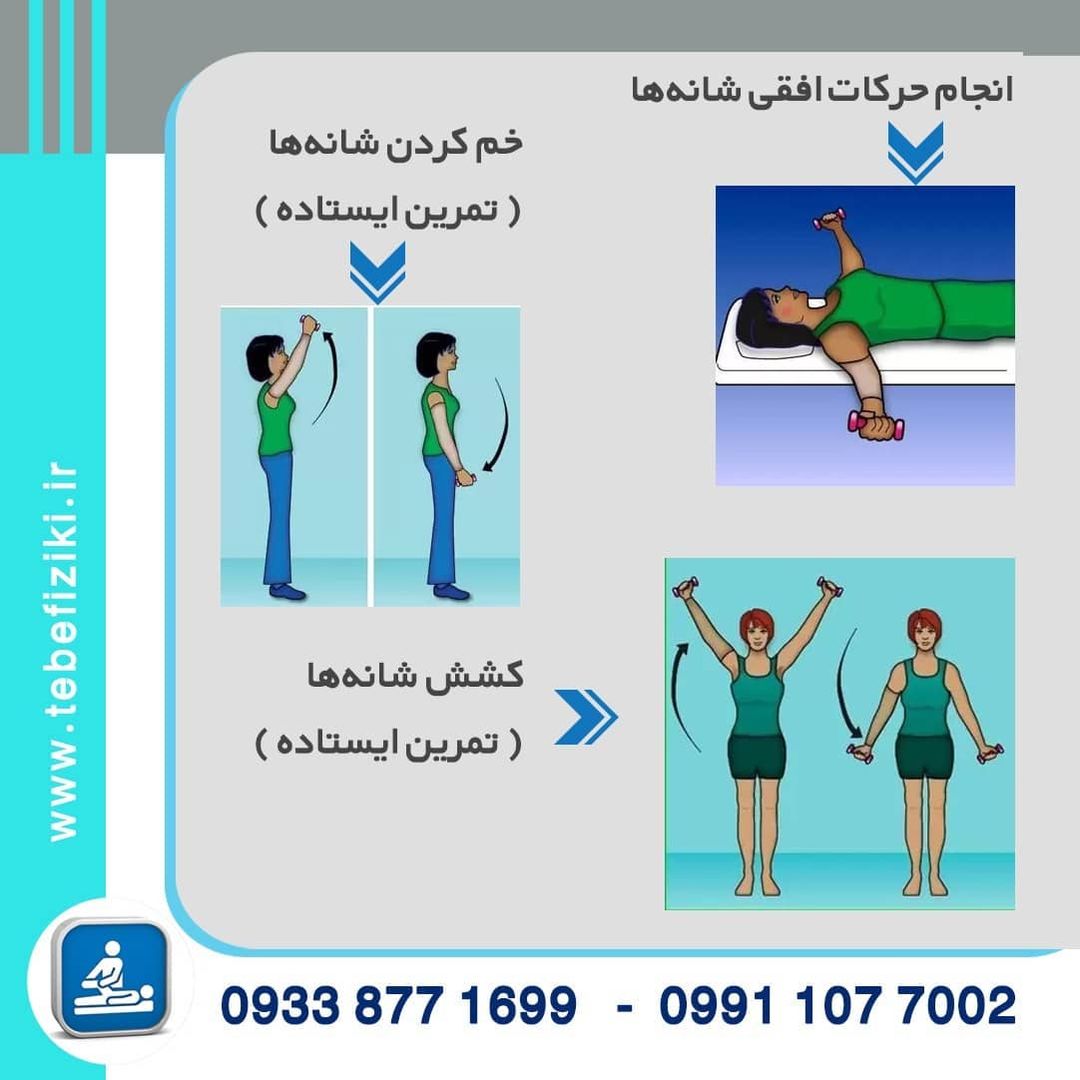 ورزش های مخصوص لنف ادم  دست و پا | متخصص طب فیزیکی و توانبخشی اصفهان