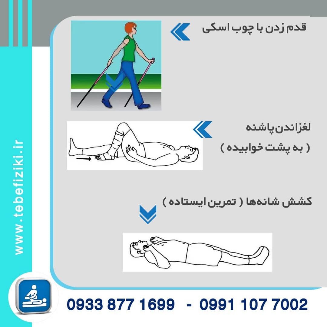 ورزش های مخصوص لنف ادم  دست و پا | متخصص طب فیزیکی و توانبخشی اصفهان