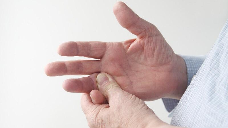 علل و علائم بیماری دوپویترین | متخصص طب فیزیکی و توانبخشی اصفهان