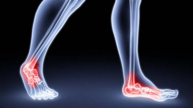 بررسی علل انواع نوروپاتی | متخصص طب فیزیکی و توانبخشی اصفهان