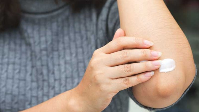 بررسی اگزما و برآمدگی در آرنج | متخصص طب فیزیکی و توانبخشی اصفهان