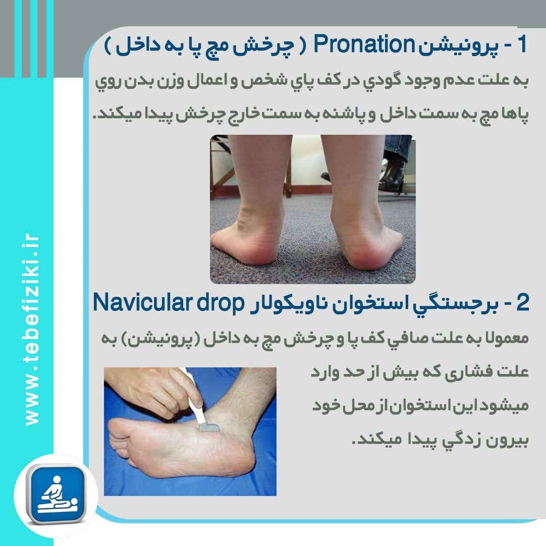 عوارض صافی کف پا | متخصص طب فیزیکی و توانبخشی اصفهان