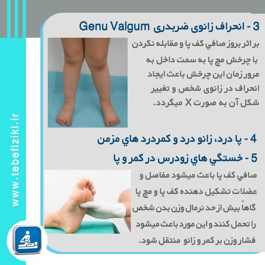 عوارض صافی کف پا | متخصص طب فیزیکی و توانبخشی اصفهان
