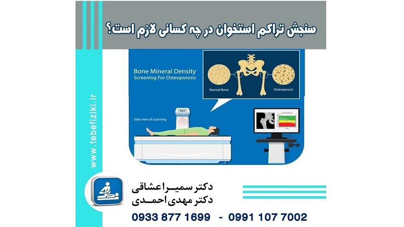 سنجش تراکم استخوان در چه کسانی لازم است؟ | متخصص طب فیزیکی و توانبخشی اصفهان