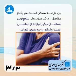 آرتروز چیست؟ | متخصص طب فیزیکی و توانبخشی اصفهان