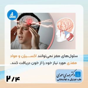 سکته مغزی و راه های درمان آن | متخصص طب فیزیکی و توانبخشی اصفهان