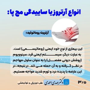 آرتروز مچ پا چیست؟ | متخصص طب فیزیکی و توانبخشی اصفهان