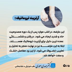 آرتروز مچ پا چیست؟ | متخصص طب فیزیکی و توانبخشی اصفهان
