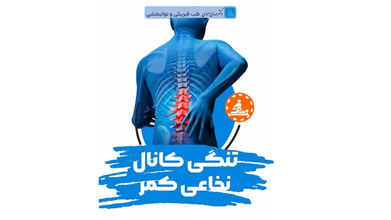 تنگی کانال نخاعی کمر | متخصص طب فیزیکی و توانبخشی اصفهان