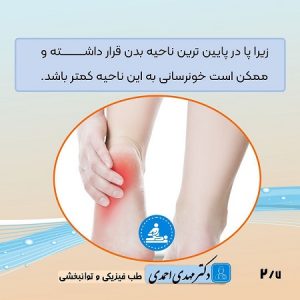 پای دیابتی چگونه ایجاد میشود؟ | متخصص طب فیزیکی و توانبخشی اصفهان