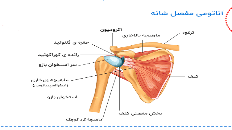 تشخیص و درمان سندروم ایمپینجمنت شانه
