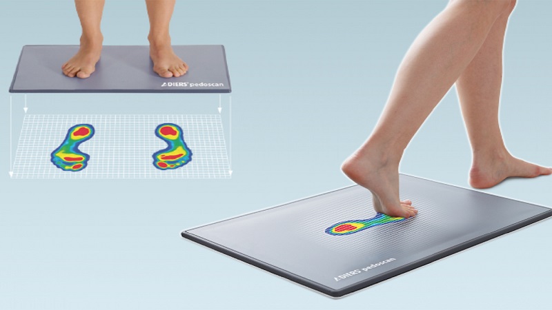 اسکن کف پا چیست؟|متخصص طب فیزیکی و توانبخشی اصفهان