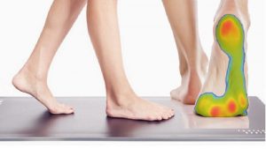 فواید اسکن کف پا و انواع دستگاه های اسکن|متخصص طب فیزیکی و توانبخشی اصفهان