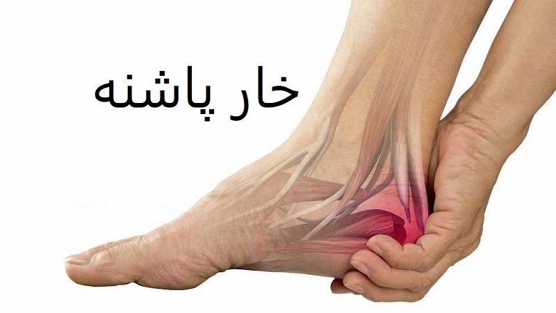 خار پاشنه چیست؟